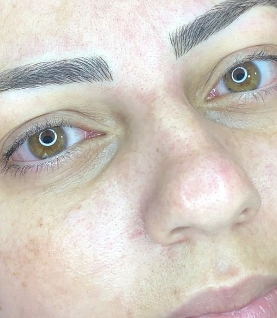 Sobrancelha alinhada com brow lamination